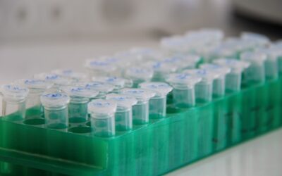 Diagnóstico de enfermedad celíaca basado en el análisis de células T en sangre periférica